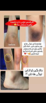 سرم روشن کننده AHA - Image 2
